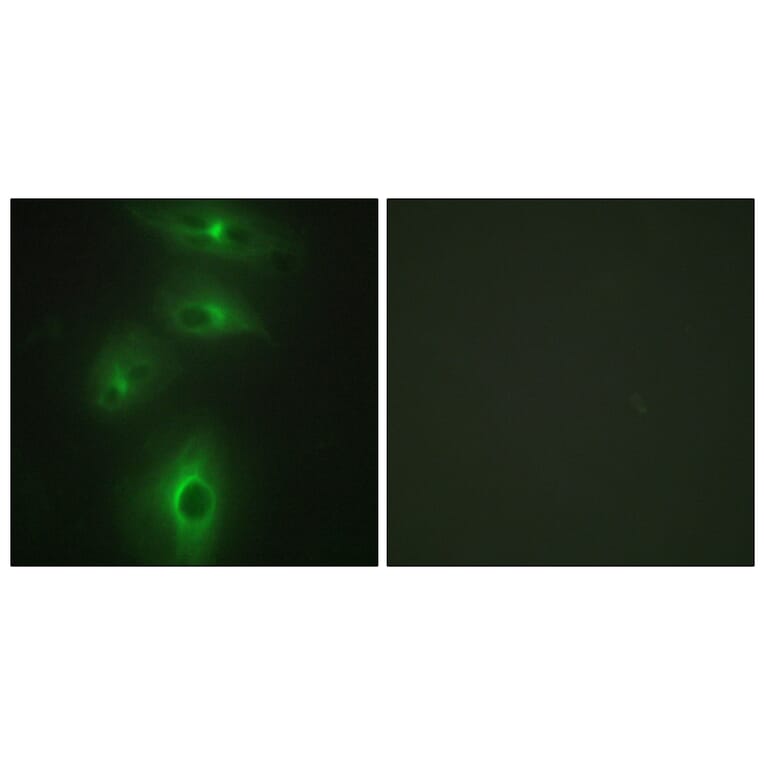 Immunofluorescence - Anti-TMPRSS3 Antibody (C10761) - Antibodies.com