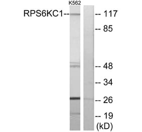 Western Blot - Anti-RPS6KC1 Antibody (C11546) - Antibodies.com
