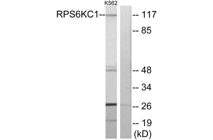 Western Blot - Anti-RPS6KC1 Antibody (C11546) - Antibodies.com