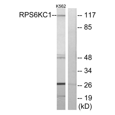 Western Blot - Anti-RPS6KC1 Antibody (C11546) - Antibodies.com