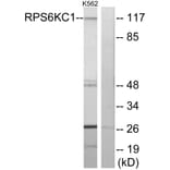Western Blot - Anti-RPS6KC1 Antibody (C11546) - Antibodies.com