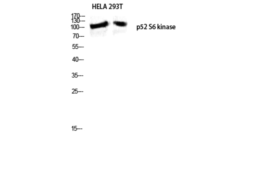 Western Blot - Anti-RPS6KC1 Antibody (C11546) - Antibodies.com