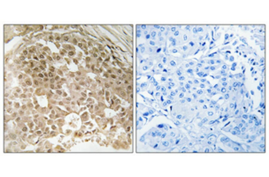 Immunohistochemistry - Anti-MORF4L1 Antibody (C11822) - Antibodies.com