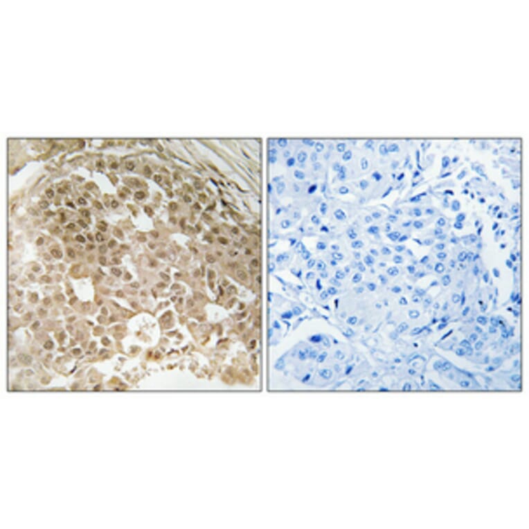 Immunohistochemistry - Anti-MORF4L1 Antibody (C11822) - Antibodies.com