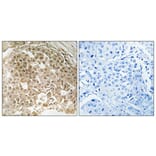 Immunohistochemistry - Anti-MORF4L1 Antibody (C11822) - Antibodies.com
