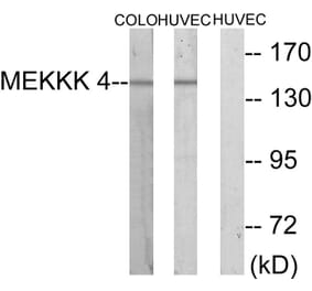 Western Blot - Anti-MEKKK 4 Antibody (C10242) - Antibodies.com