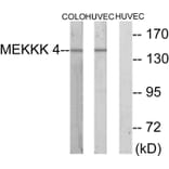 Western Blot - Anti-MEKKK 4 Antibody (C10242) - Antibodies.com