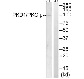 Western Blot - Anti-PKC mu Antibody (B0721) - Antibodies.com