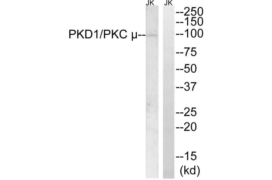 Western Blot - Anti-PKC mu Antibody (B0721) - Antibodies.com
