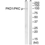 Western Blot - Anti-PKC mu Antibody (B0721) - Antibodies.com