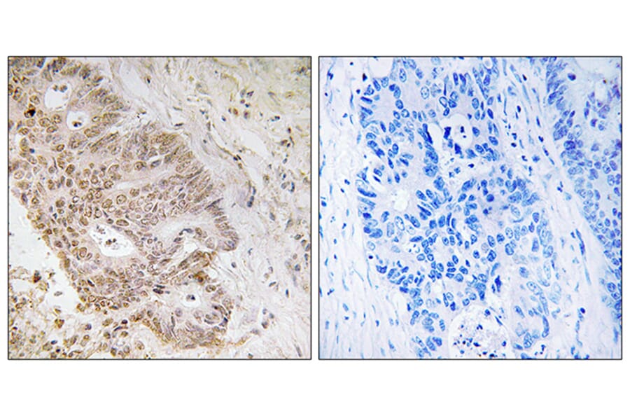 Immunohistochemistry - Anti-ZNF592 Antibody (C19603) - Antibodies.com