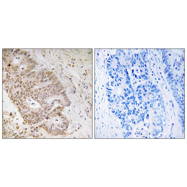 Immunohistochemistry - Anti-ZNF592 Antibody (C19603) - Antibodies.com