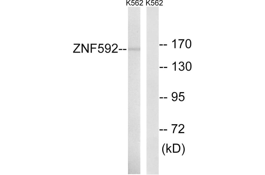 Western Blot - Anti-ZNF592 Antibody (C19603) - Antibodies.com