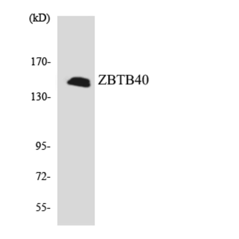 Western Blot - Anti-ZBTB40 Antibody (R12-3686) - Antibodies.com