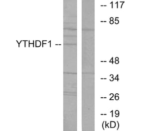 Western Blot - Anti-YTHDF1 Antibody (C11643) - Antibodies.com