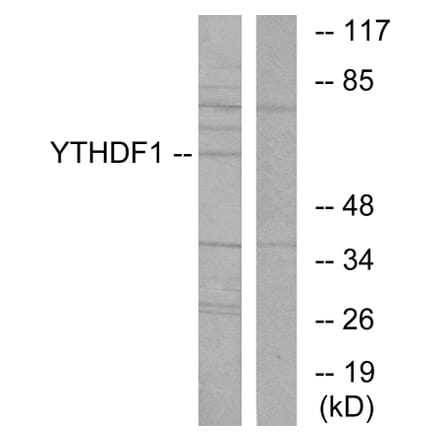 Western Blot - Anti-YTHDF1 Antibody (C11643) - Antibodies.com