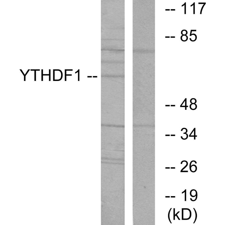 Western Blot - Anti-YTHDF1 Antibody (C11643) - Antibodies.com