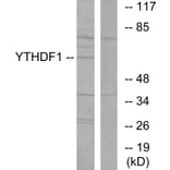 Western Blot - Anti-YTHDF1 Antibody (C11643) - Antibodies.com