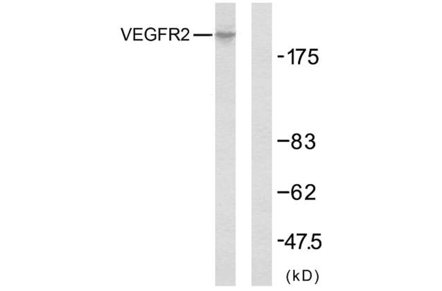 Western Blot - Anti-VEGFR2 Antibody (B7254) - Antibodies.com