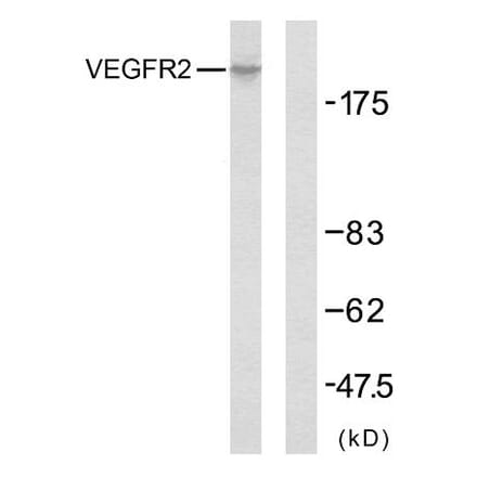 Western Blot - Anti-VEGFR2 Antibody (B7254) - Antibodies.com