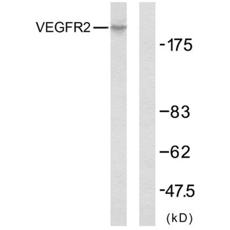 Western Blot - Anti-VEGFR2 Antibody (B7254) - Antibodies.com