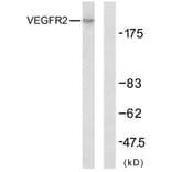 Western Blot - Anti-VEGFR2 Antibody (B7254) - Antibodies.com