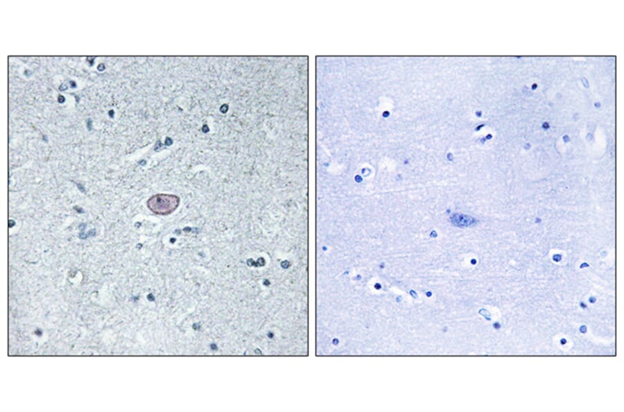 Immunohistochemistry - Anti-VEGFR2 Antibody (B7254) - Antibodies.com