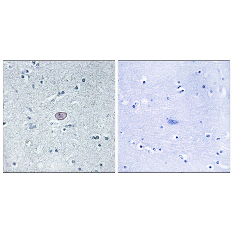 Immunohistochemistry - Anti-VEGFR2 Antibody (B7254) - Antibodies.com