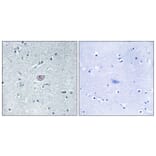 Immunohistochemistry - Anti-VEGFR2 Antibody (B7254) - Antibodies.com