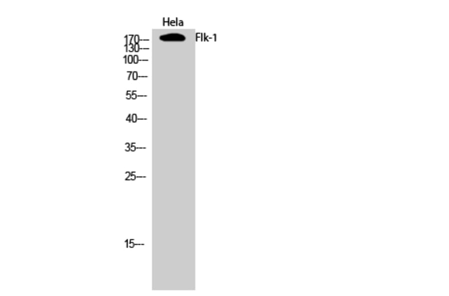 Western Blot - Anti-VEGFR2 Antibody (B7254) - Antibodies.com