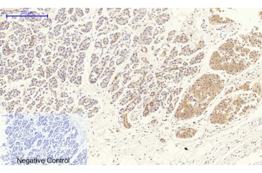 Immunohistochemistry - Anti-VEGFR2 Antibody (B7254) - Antibodies.com