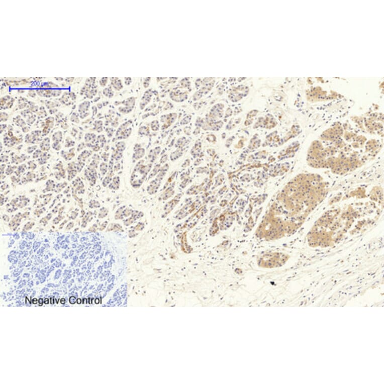 Immunohistochemistry - Anti-VEGFR2 Antibody (B7254) - Antibodies.com