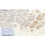Immunohistochemistry - Anti-VEGFR2 Antibody (B7254) - Antibodies.com