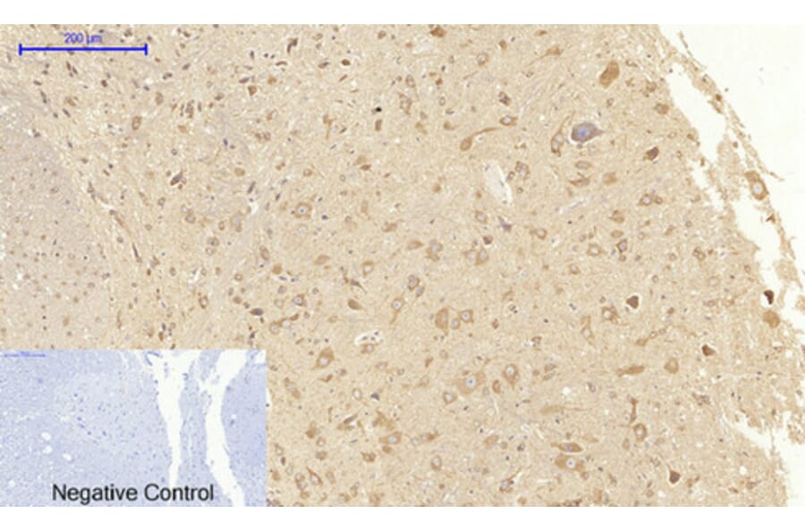Immunohistochemistry - Anti-VEGFR2 Antibody (B7254) - Antibodies.com