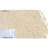 Immunohistochemistry - Anti-VEGFR2 Antibody (B7254) - Antibodies.com