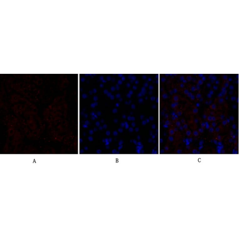 Immunofluorescence - Anti-VEGFR2 Antibody (B7254) - Antibodies.com