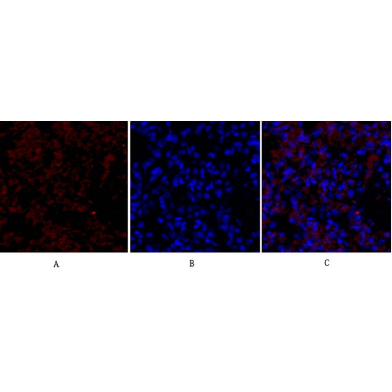 Immunofluorescence - Anti-VEGFR2 Antibody (B7254) - Antibodies.com