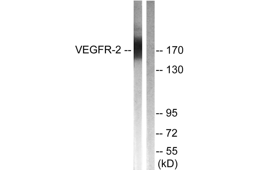 Western Blot - Anti-VEGFR2 Antibody (B0595) - Antibodies.com