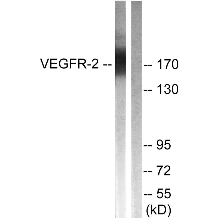 Western Blot - Anti-VEGFR2 Antibody (B0595) - Antibodies.com