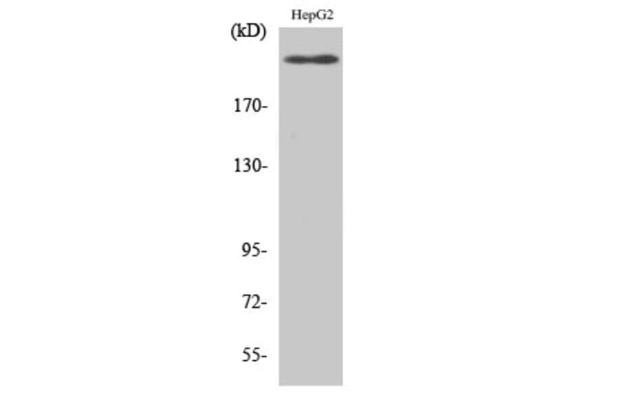 Western Blot - Anti-VEGFR2 Antibody (B0595) - Antibodies.com
