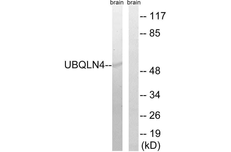Western Blot - Anti-UBQLN4 Antibody (C19354) - Antibodies.com