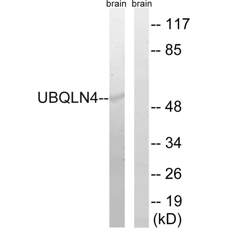 Western Blot - Anti-UBQLN4 Antibody (C19354) - Antibodies.com