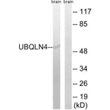 Western Blot - Anti-UBQLN4 Antibody (C19354) - Antibodies.com