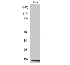 Western Blot - Anti-UBE2D2 Antibody (C19428) - Antibodies.com