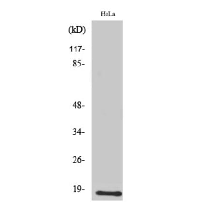 Western Blot - Anti-UBE2D2 Antibody (C19428) - Antibodies.com