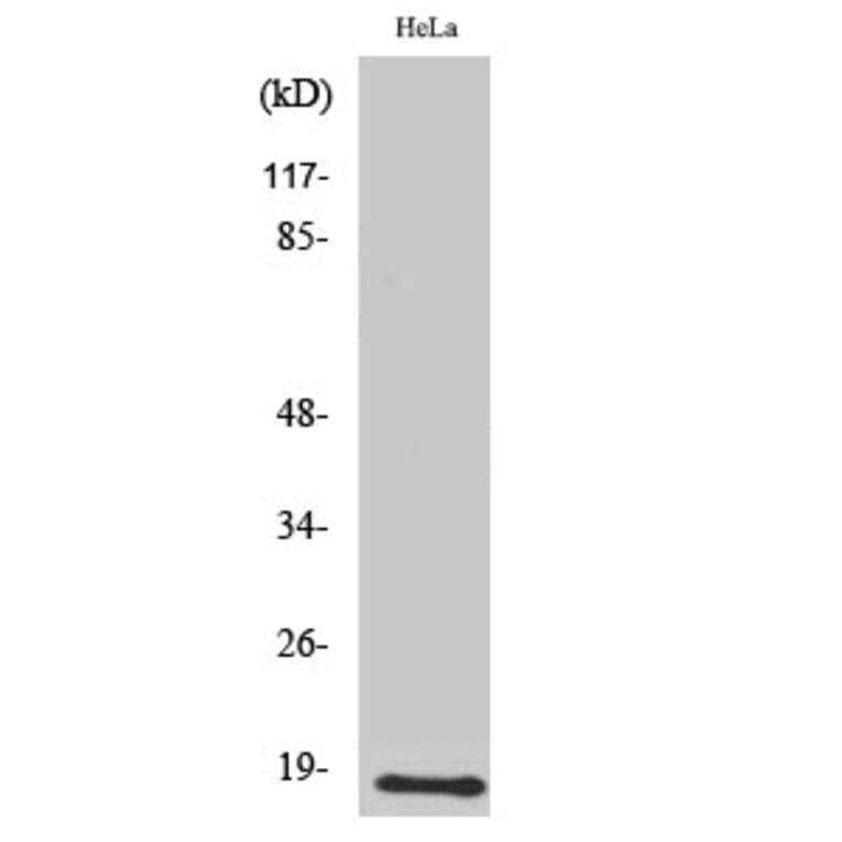 Western Blot - Anti-UBE2D2 Antibody (C19428) - Antibodies.com