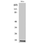 Western Blot - Anti-UBE2D2 Antibody (C19428) - Antibodies.com