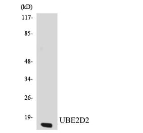 Western Blot - Anti-UBE2D2 Antibody (R12-3662) - Antibodies.com