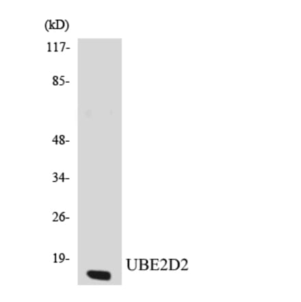 Western Blot - Anti-UBE2D2 Antibody (R12-3662) - Antibodies.com