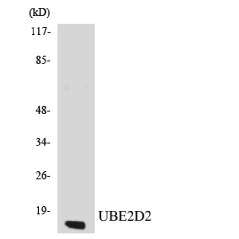 Western Blot - Anti-UBE2D2 Antibody (R12-3662) - Antibodies.com